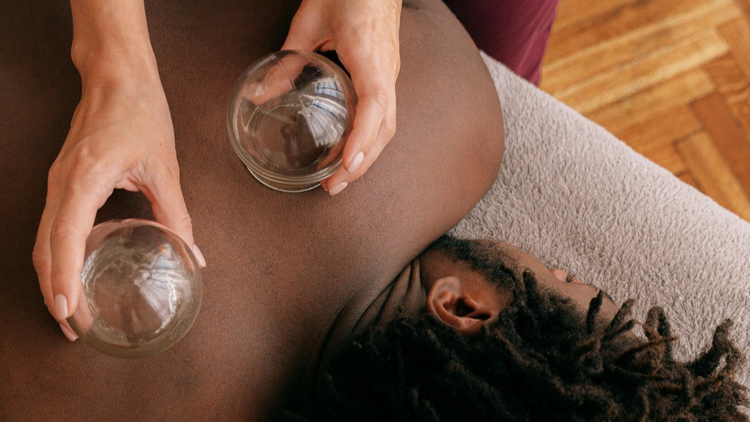 soft tissue modalities - cupping